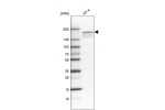 Western blot analysis in human cell line RT-4.