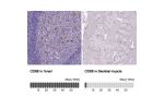 Immunohistochemical staining of human liver shows strong immunoreactivity in Kupffer cells.
