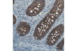 Immunohistochemical staining of human colon shows strong membranous immunoreactivity in glandular cells.