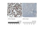 Immunohistochemistry analysis in human placenta and tonsil tissues using AMAb90909 antibody. Corresponding ATF3 RNA-seq data are presented for the same tissues.