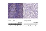 Immunohistochemistry analysis in human tonsil and kidney tissues using AMAb90915 antibody. Corresponding ITGAX RNA-seq data are presented for the same tissues.