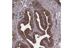Immunohistochemical staining of human fallopian tube shows strong granular cytoplasmic positivity in glandular cells.