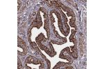 Immunohistochemical staining of human fallopian tube shows strong granular cytoplasmic positivity in glandular cells.