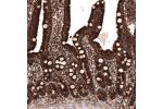 Immunohistochemical staining of human skin shows granular cytoplasmic immunoreactivity in epithelial cells.