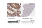 Immunohistochemistry analysis in human testis and skeletal muscle tissues using AMAb90967 antibody. Corresponding VPS26A RNA-seq data are presented for the same tissues.