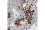 Immunohistochemical staining of human testis shows strong cytoplasmic immunoreactivity in a subset of cells in seminiferous tubules.