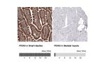 Immunohistochemical staining of human cerebellum shows cytoplasmic immunoreactivity in Purkinje cells.