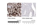 Immunohistochemical staining of human small intestine shows strong cytoplasmic immunoreactivityin glandular epithelium and lamina propria cells.
