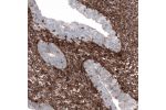 Immunohistochemical staining of human endometrium shows strong cytoplasmic positivity in stromal cells.