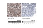 Immunohistochemistry analysis in human liver and pancreas tissues using AMAb90995 antibody. Corresponding ABCD3 RNA-seq data are presented for the same tissues.