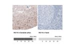 Immunohistochemical staining of human cerebellum shows moderate immunoreactivity in Purkinje cells and neural fibers.
