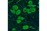 Immunohistochemical staining of rat brainstem shows strong immunoreactivity in neurons of mesencephalic trigeminal nucleus.