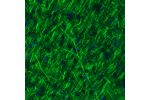 Immunohistochemical staining of rat cerebral cortex shows strong immunoreactivity in neuronal processes.