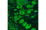 Immunohistochemical staining of rat brainstem shows strong immunoreactivity in mesencephalic trigeminal nucleus neurons.