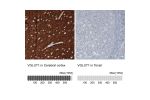 Immunohistochemistry analysis in human cerebral cortex and tonsil tissues using AMAb91041 antibody. Corresponding VGLUT1 RNA-seq data are presented for the same tissues.
