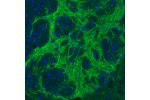 Immunofluorescence staining of rat basal forebrain shows strong positivity in GABAergic fibers in the globus pallidus.
