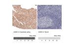 Immunohistochemistry analysis in human cerebral cortex and tonsil tissues using AMAb91048 antibody. Corresponding GAD2 RNA-seq data are presented for the same tissues.