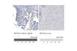 Immunohistochemistry analysis in human cervix, uterine and liver tissues using AMAb91056 antibody. Corresponding MUC16 RNA-seq data are presented for the same tissues.