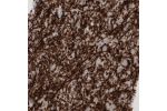 Immunohistochemical staining of human cerebral cortex shows strong immunoreactivity in myelinated fibers.