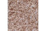 Immunohistochemical staining of human cerebral cortex shows strong immunoreactivity in myelinated fibers.