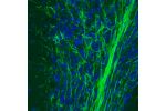 Immunohistochemical staining of rat cerebellum shows strong immunoreactivity in myelinated neural fibers.