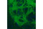 Immunohistochemical staining of rat globus pallidus shows strong immunoreactivity in GABAergic neural fibers.