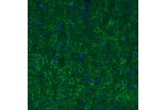 Immunohistochemical staining of rat cerebral cortex shows strong immunoreactivity in GABAergic synapses on pyramidal neurons.