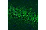 Immunohistochemical staining of rat hippocampal formation shows strong positivity in GABAergic fibers in the CA1 area.