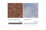 Immunohistochemistry analysis in human cerebral cortex and tonsil tissues using AMAb91081 antibody. Corresponding VGLUT2 RNA-seq data are presented for the same tissues.