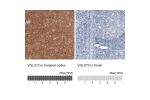 Immunohistochemistry analysis in human cerebral cortex and tonsil tissues using AMAb91086 antibody. Corresponding VGLUT2 RNA-seq data are presented for the same tissues.