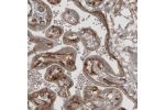 Immunohistochemical staining of human placenta shows moderate immunoreactivity in basement membrane of trophoblast and in endothelium.