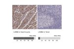 Immunohistochemistry analysis in human heart muscle and tonsil tissues using AMAb91097 antibody. Corresponding LAMB2 RNA-seq data are presented for the same tissues.