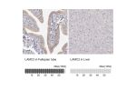 Immunohistochemistry analysis in human fallopian tube and liver tissues using AMAb91098 antibody. Corresponding LAMC2 RNA-seq data are presented for the same tissues.