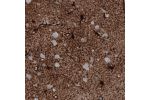 Immunohistochemical staining of human cerebral cortex shows strong immunoreactivity in astrocytes.