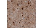 Immunohistochemical staining of human cerebral cortex shows strong immunoreactivity in astrocytes.