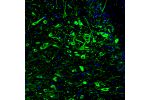 Immunofluorescence staining of rat midbrain shows strong positivity in serotonin neurons in the dorsal raphe nucleus.