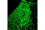Immunofluorescence staining of rat pons shows strong positivity in noradrenalne neurons in the locus coeruleus.
