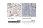 Immunohistochemistry analysis in human testis and lymph node tissues using AMAb91117 antibody. Corresponding LAMA1 RNA-seq data are presented for the same tissues.