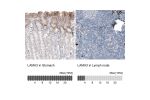 Immunohistochemistry analysis in human stomach and lymph node tissues using AMAb91123 antibody. Corresponding LAMA3 RNA-seq data are presented for the same tissues.