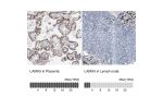 Immunohistochemistry analysis in human placenta and lymph node tissues using AMAb91124 antibody. Corresponding LAMA5 RNA-seq data are presented for the same tissues.