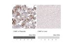 Immunohistochemistry analysis in human placenta and liver tissues using AMAb91130 antibody. Corresponding CHAT RNA-seq data are presented for the same tissues.
