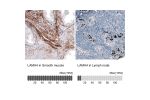 Immunohistochemistry analysis in human smooth muscle and lymph node tissues using AMAb91134 antibody. Corresponding LAMA4 RNA-seq data are presented for the same tissues.
