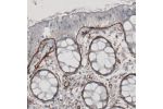 Immunohistochemical staining of human rectum shows strong immunoreactivity in basement membrane of glandular epithelium.
