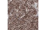Immunohistochemical staining of human heart shows strong membranous immunoreactivity in cardiomyocytes.