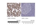 Immunohistochemistry analysis in human placenta and tonsil tissues using AMAb91138 antibody. Corresponding LAMC1 RNA-seq data are presented for the same tissues.