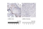 Immunohistochemistry analysis in human skin and pancreas tissues using AMAb91160 antibody. Corresponding LAMB3 RNA-seq data are presented for the same tissues.