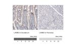 Immunohistochemistry analysis in human duodenum and pancreas tissues using AMAb91161 antibody. Corresponding LAMB3 RNA-seq data are presented for the same tissues.