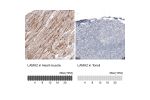 Immunohistochemistry analysis in human heart muscle and tonsil tissues using AMAb91166 antibody. Corresponding LAMA2 RNA-seq data are presented for the same tissues.