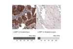 Immunohistochemistry analysis in human endometrium and skeletal muscle tissues using AMAb91170 antibody. Corresponding LAMP1 RNA-seq data are presented for the same tissues.