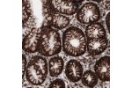 Immunohistochemical staining of human stomach shows strong cytoplasmic immunoreactivity in glandular epithelium cells.